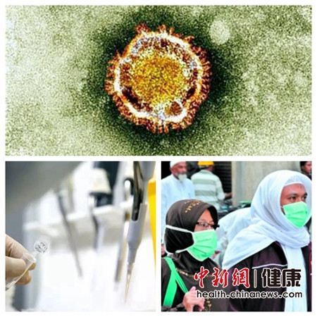 ���y���_MERS�P�V���F���ֺɲ�:�������_�������W