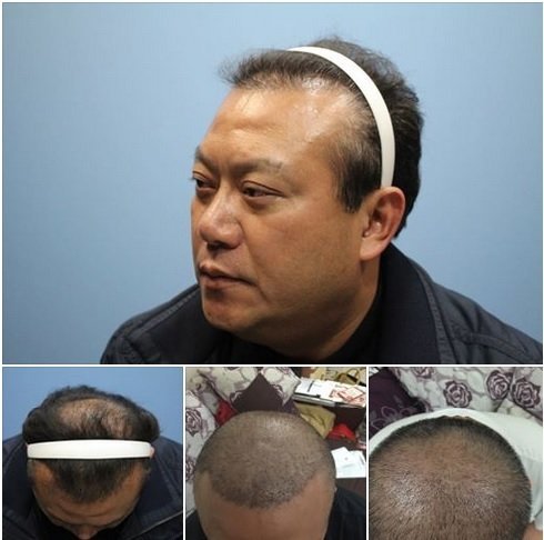 ����ؓr���n�z�A���q��~���[�w�I�͡L�I�L��