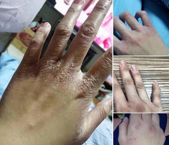 ޽�f�f��~���[�����ʕ[��������W�����s���I��