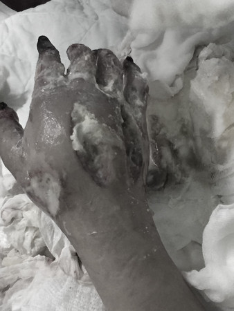 ��藍�ӿY���ɪ���w�Y��17�Ф֒��Y�鿧����I�n