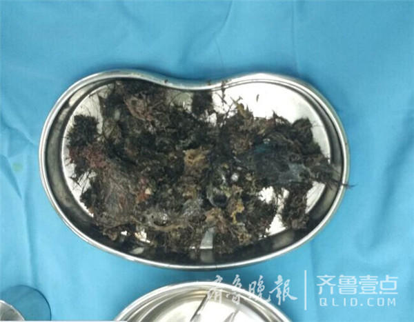 5�В��R�Δ@�� 楨���|�������ץ�