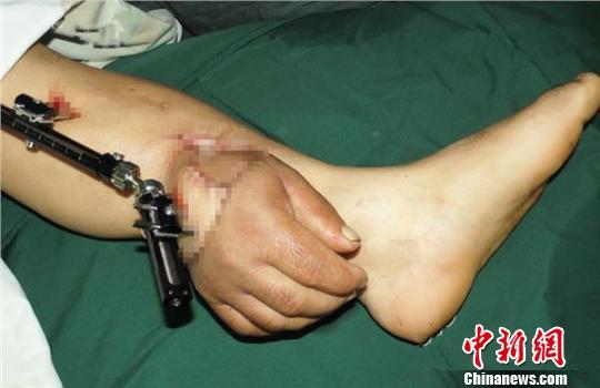 ����@��Lڹ�l������ 30�����A�K��ï�E�|�K