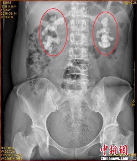 Òﮢ͕V30eZn10g˾ץ