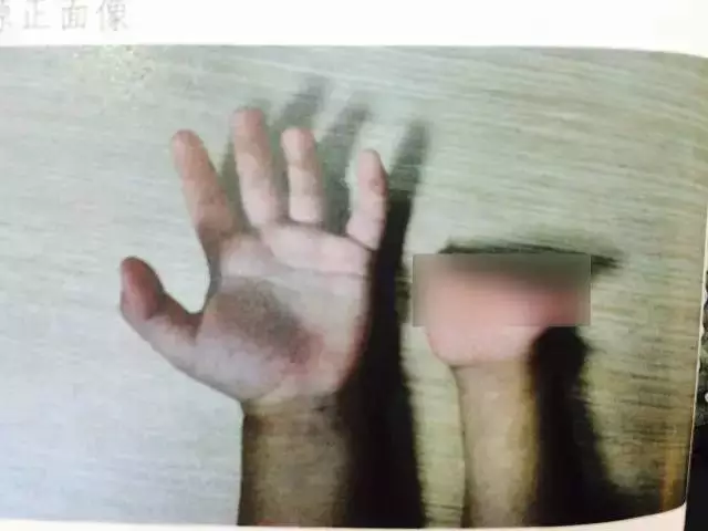 ���]�O�[�������͒خB��Q� ���g�E�w���|����