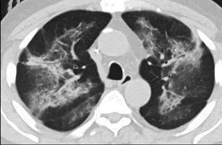 6���A�Yɨ��CT���f�ʹ_���ܤ�������]�n�t�]�Q�a���׺c��T��(���ïf��CT���_)