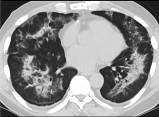 6���A�Yɨ��CT���f�ʹ_���ܤ�������]�n�t�]�Q�a���׺c��T��(���ïf��CT���_)