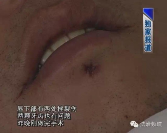 周口市公安局七一路派出所民警介紹，行兇者打人後，當場棄車逃離。目前，案件正在進一步調查中。