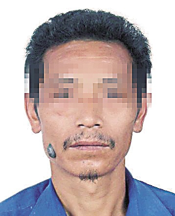 男子臉上祛痣後與係統照片不符