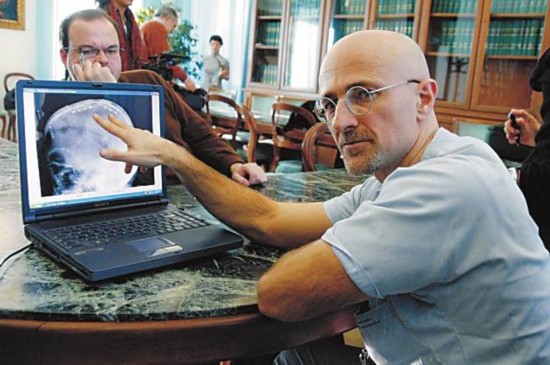 圖為卡納維洛醫生,不少人認為他的想法非常瘋狂